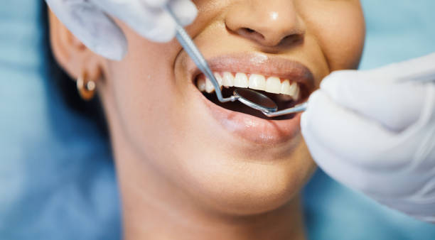 Best Emergency Tooth Extraction in Bellevue, WA